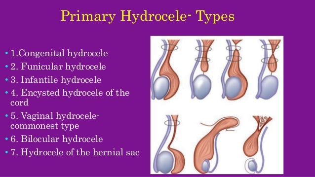 Scrotal Swellings 1 Scrotal Swellings 1