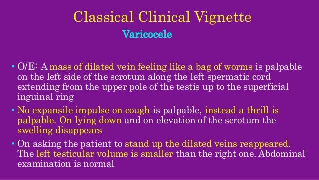 Scrotal Swellings 4 Varicocele