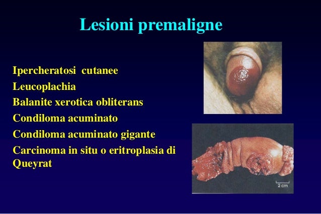 Medicine di varicosity con un castano come il cavallo