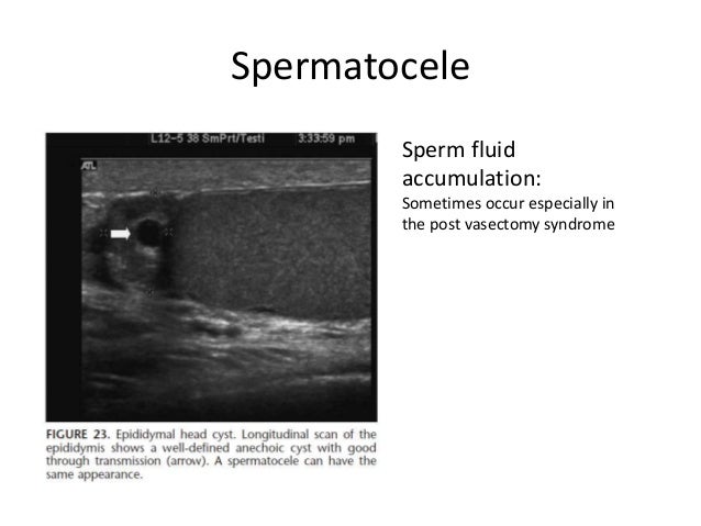 Scrotum echo