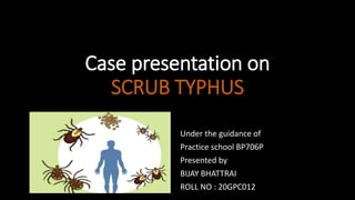 Case presentation on
SCRUB TYPHUS
Under the guidance of
Practice school BP706P
Presented by
BIJAY BHATTRAI
ROLL NO : 20GPC012
 