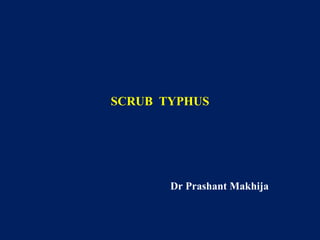 SCRUB TYPHUS

Dr Prashant Makhija

 