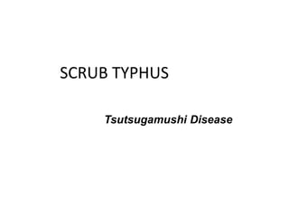 SCRUB TYPHUS
Tsutsugamushi Disease
 