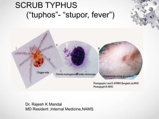 SCRUB TYPHUS
(“tuphos”- “stupor, fever”)
Dr. Rajesh K Mandal
MD Resident ,Internal Medicine,NAMS
 