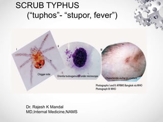 SCRUB TYPHUS
(“tuphos”- “stupor, fever”)
Dr. Rajesh K Mandal
MD,Internal Medicine,NAMS
 