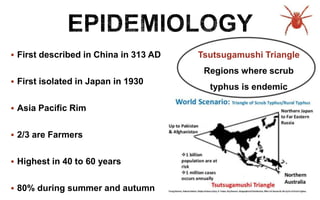 First described in China in 313 AD
 First isolated in Japan in 1930
 Asia Pacific Rim
 2/3 are Farmers
 Highest in 40 to 60 years
 80% during summer and autumn
Tsutsugamushi Triangle
Regions where scrub
typhus is endemic
 