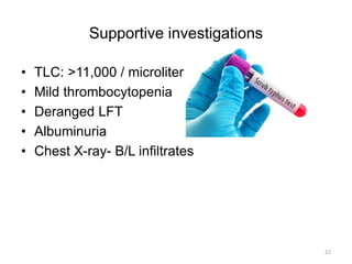 Supportive investigations
• TLC: >11,000 / microliter
• Mild thrombocytopenia
• Deranged LFT
• Albuminuria
• Chest X-ray- ...