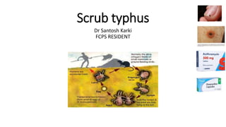 Scrub typhus
Dr Santosh Karki
FCPS RESIDENT
 