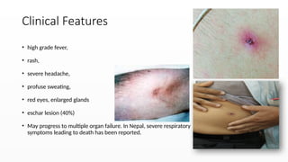 Scrub Typhus-manageent in nepal (1).pptx