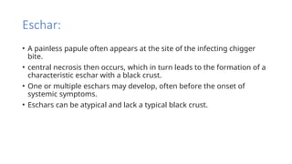 Comprehensive Overview of Scrub Typhus: Epidemiology, Clinical Features ...
