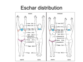 Eschar distribution
 