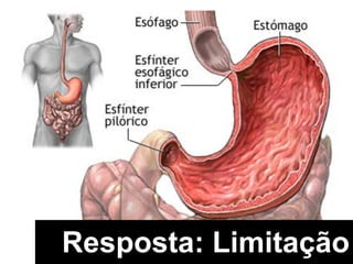 Resposta: Limitação
 