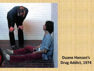 Duane Hanson’s
Drug Addict, 1974
 