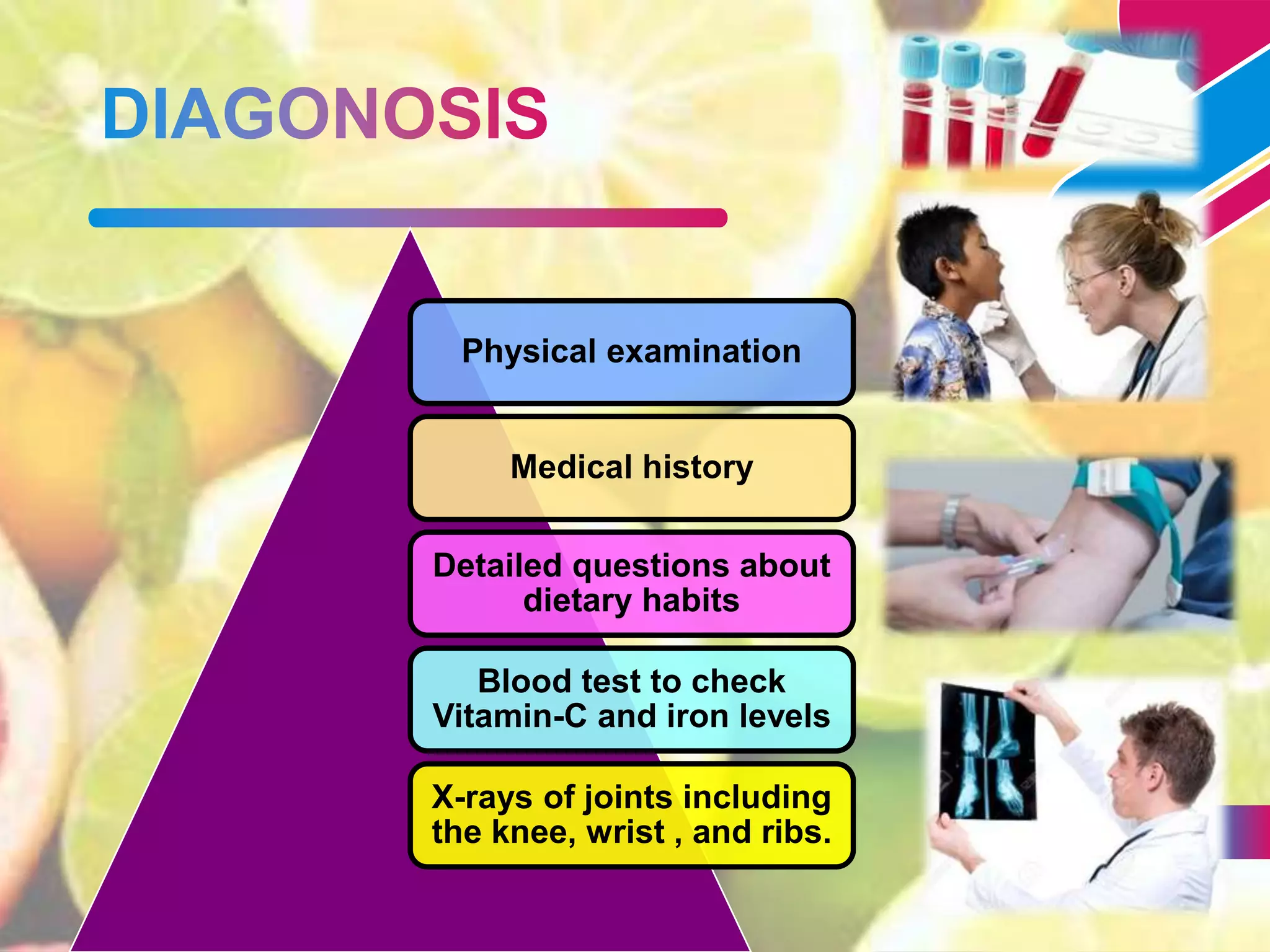 vitamin-c-deficiency-disease-scurvy-ppt