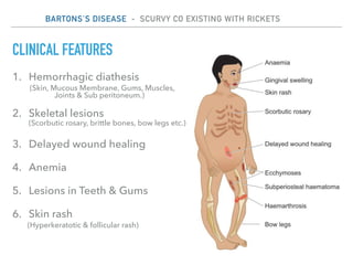 Scurvy | PDF