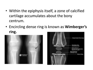 • Within the epiphysis itself, a zone of calcified
cartilage accumulates about the bony
centrum.
• Encircling dense ring is known as Wimberger’s
ring.
 