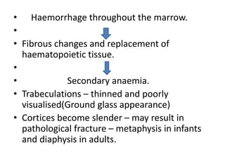 • Haemorrhage throughout the marrow.
•
• Fibrous changes and replacement of
haematopoietic tissue.
•
• Secondary anaemia.
• Trabeculations – thinned and poorly
visualised(Ground glass appearance)
• Cortices become slender – may result in
pathological fracture – metaphysis in infants
and diaphysis in adults.
 