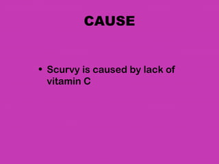 CAUSE


• Scurvy is caused by lack of
  vitamin C
 