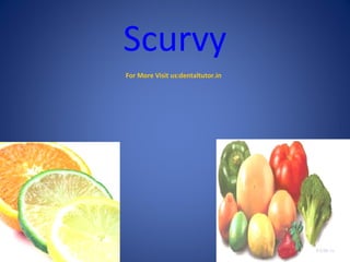 Scurvy
For More Visit us:dentaltutor.in
 