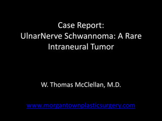 Case Report:UlnarNerve Schwannoma: A Rare Intraneural Tumor W. Thomas McClellan, M.D. www.morgantownplasticsurgery.com 