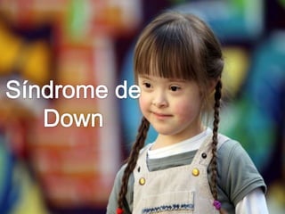 Sindrome de Down