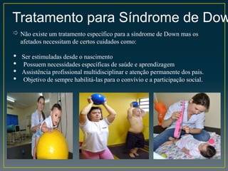 Tratamento para Síndrome de Dow
⇨ Não existe um tratamento específico para a síndrome de Down mas os
afetados necessitam de certos cuidados como:
• Ser estimuladas desde o nascimento
• Possuem necessidades específicas de saúde e aprendizagem
• Assistência profissional multidisciplinar e atenção permanente dos pais.
• Objetivo de sempre habilitá-las para o convívio e a participação social.
 