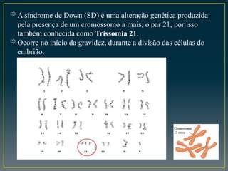 ⇨A síndrome de Down (SD) é uma alteração genética produzida
pela presença de um cromossomo a mais, o par 21, por isso
também conhecida como Trissomia 21.
⇨Ocorre no início da gravidez, durante a divisão das células do
embrião.
 