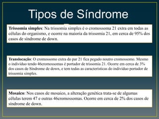 Tipos de Síndrome
DownTrissomia simples: Na trissomia simples é o cromossoma 21 extra em todas as
células do organismo, e ocorre na maioria da trissomia 21, em cerca de 95% dos
casos de síndrome de down.
Translocação: O cromossomo extra do par 21 fica pegado noutro cromossomo. Mesmo
o indivíduo tendo 46cromossomas é portador de trissomia 21. Ocorre em cerca de 3%
dos casos de Síndrome de down, e tem todas as características do indivíduo portador de
trissomia simples.
Mosaico: Nos casos de mosaico, a alteração genética trata-se de algumas
células terem 47 e outras 46cromossomas. Ocorre em cerca de 2% dos casos de
síndrome de down.
 