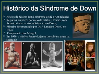 ⇨ Relatos de pessoas com a síndrome desde a Antiguidade;
⇨ Registros históricos por meio de estátuas; Crânios com
formato similar as dos indivíduos com Down;
⇨ Primeira documentação por Dr. J. Langdon Down, em
1866;
⇨ Comparação com Mongol;
⇨ Em 1959, o médico Jerome Lejeune descobriu a causa da
síndrome.
 