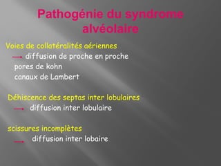 Lambert Diffusion syndrome alvéolaire. pneumologie.radiologie | PPTX