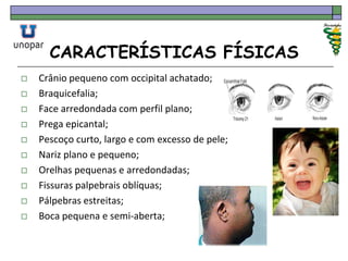 CARACTERÍSTICAS FÍSICAS
 Crânio pequeno com occipital achatado;
 Braquicefalia;
 Face arredondada com perfil plano;
 Prega epicantal;
 Pescoço curto, largo e com excesso de pele;
 Nariz plano e pequeno;
 Orelhas pequenas e arredondadas;
 Fissuras palpebrais oblíquas;
 Pálpebras estreitas;
 Boca pequena e semi-aberta;
 