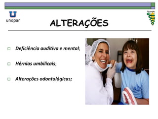ALTERAÇÕES
 Deficiência auditiva e mental;
 Hérnias umbilicais;
 Alterações odontológicas;
 