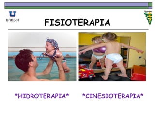 FISIOTERAPIA
*HIDROTERAPIA* *CINESIOTERAPIA*
 