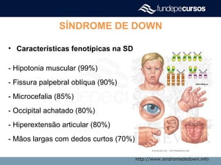 SÍNDROME DE DOWN
• Características fenotípicas na SD
- Hipotonia muscular (99%)
- Fissura palpebral oblíqua (90%)
- Microcefalia (85%)
- Occipital achatado (80%)
- Hiperextensão articular (80%)
- Mãos largas com dedos curtos (70%)
http://www.sindromededown.infohttp://www.sindromededown.info
 