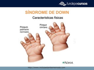 SÍNDROME DE DOWN
Características físicasCaracterísticas físicas
http://www.inclusaotambememoda.comhttp://www.inclusaotambememoda.com
 