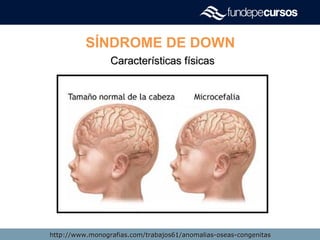 SÍNDROME DE DOWN
Características físicasCaracterísticas físicas
http://www.monografias.com/trabajos61/anomalias-oseas-congenitashttp://www.monografias.com/trabajos61/anomalias-oseas-congenitas
 