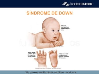 SÍNDROME DE DOWN
Características físicasCaracterísticas físicas
http://www.healthyhippie.net/down-syndromehttp://www.healthyhippie.net/down-syndrome
 