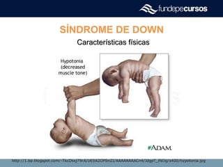 SÍNDROME DE DOWN
Características físicasCaracterísticas físicas
http://1.bp.blogspot.com/-TkcOsxj79rA/UE5A2OPSnZI/AAAAAAAACn4/JdgpT_lNIJg/s400/hypotonia.jpghttp://1.bp.blogspot.com/-TkcOsxj79rA/UE5A2OPSnZI/AAAAAAAACn4/JdgpT_lNIJg/s400/hypotonia.jpg
 