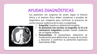 AYUDAS DIAGNÓSTICAS
Los pacientes con sospecha de ascitis según la historia
clínica y el examen físico deben someterse a pruebas de
diagnóstico por imágenes para confirmar la presencia de
ascitis y buscar evidencia de cirrosis o malignidad.
○ Ecografia: hepatica o abdominal completa.
○ En pacientes con cirrosis, la ecografía, la TC o la
resonancia magnética pueden revelar evidencia
de un hígado nodular.
○ Paracentesis: la paracentesis abdominal es
fundamental para determinar la causa de la ascitis
y descartar o confirmar la peritonitis bacteriana
espontánea (PBE).
 