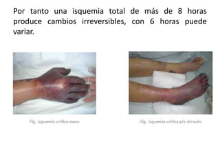 Por tanto una isquemia total de más de 8 horas
produce cambios irreversibles, con 6 horas puede
variar.
 