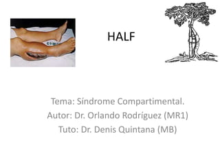 HALF
Tema: Síndrome Compartimental.
Autor: Dr. Orlando Rodríguez (MR1)
Tuto: Dr. Denis Quintana (MB)
 