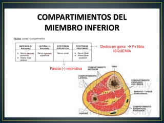 Dedos en garra  Fx tibia
ISQUEMIA
Fascia (-) restrictiva
 