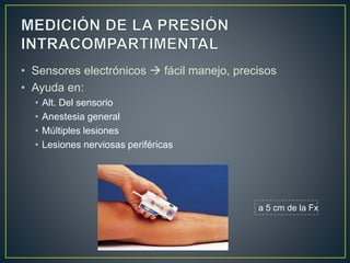 • Sensores electrónicos  fácil manejo, precisos
• Ayuda en:
• Alt. Del sensorio
• Anestesia general
• Múltiples lesiones
• Lesiones nerviosas periféricas
a 5 cm de la Fx
 
