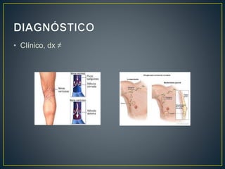 • Clínico, dx ≠
 