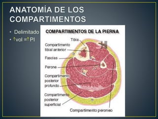 • Delimitado
• vol = PI
 