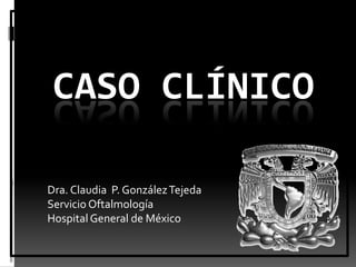 CASO CLíNICO Dra. Claudia  P. González Tejeda Servicio Oftalmología Hospital General de México 