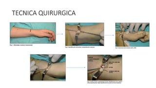 TECNICA QUIRURGICA
 