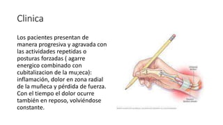 Clinica
Los pacientes presentan de
manera progresiva y agravada con
las actividades repetidas o
posturas forzadas ( agarre
energico combinado con
cubitalizacion de la mu;eca):
inflamación, dolor en zona radial
de la muñeca y pérdida de fuerza.
Con el tiempo el dolor ocurre
también en reposo, volviéndose
constante.
 
