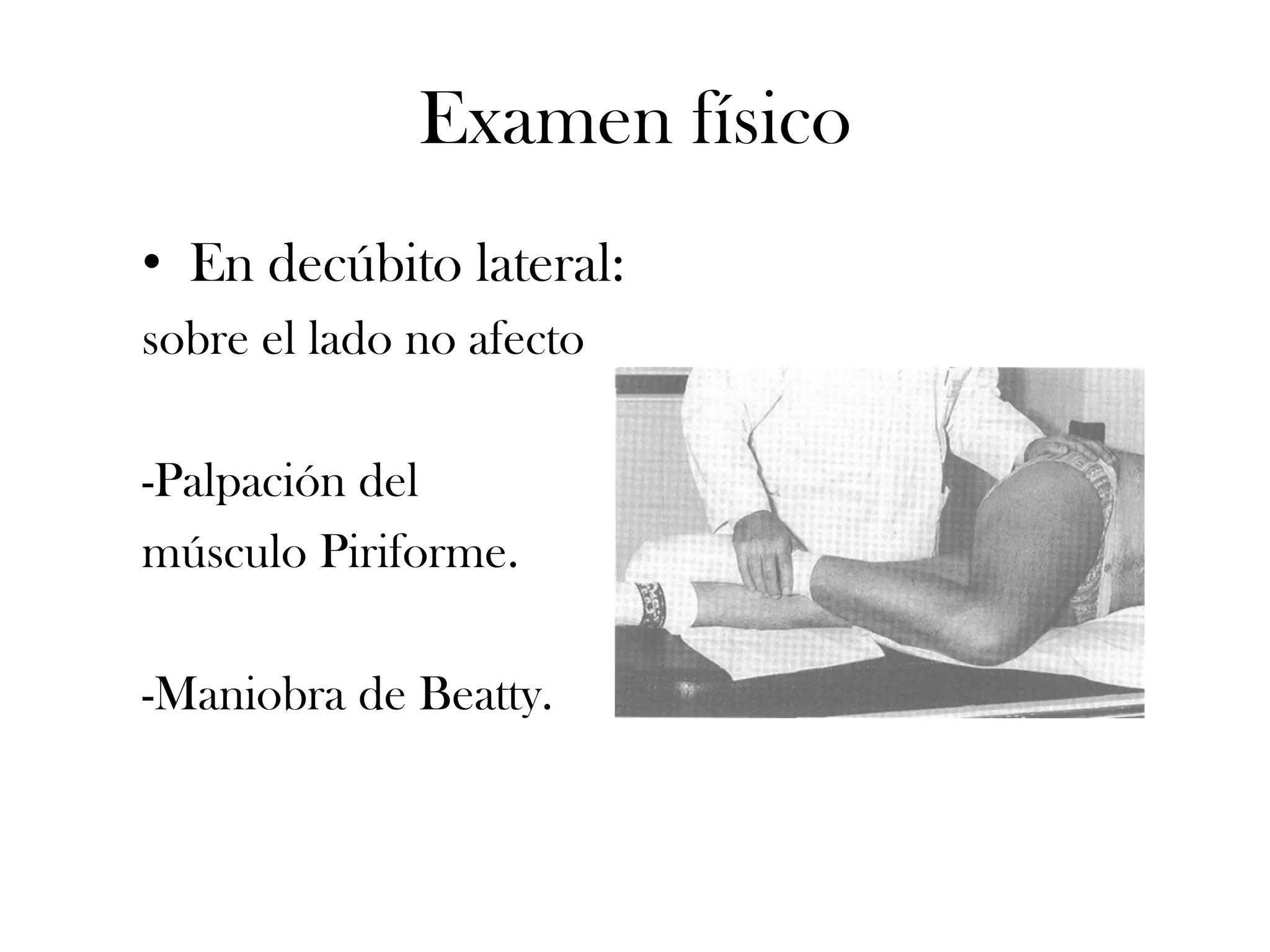 Examen físico
• En decúbito lateral:
sobre el lado no afecto

-Palpación del
músculo Piriforme.

-Maniobra de Beatty.
 