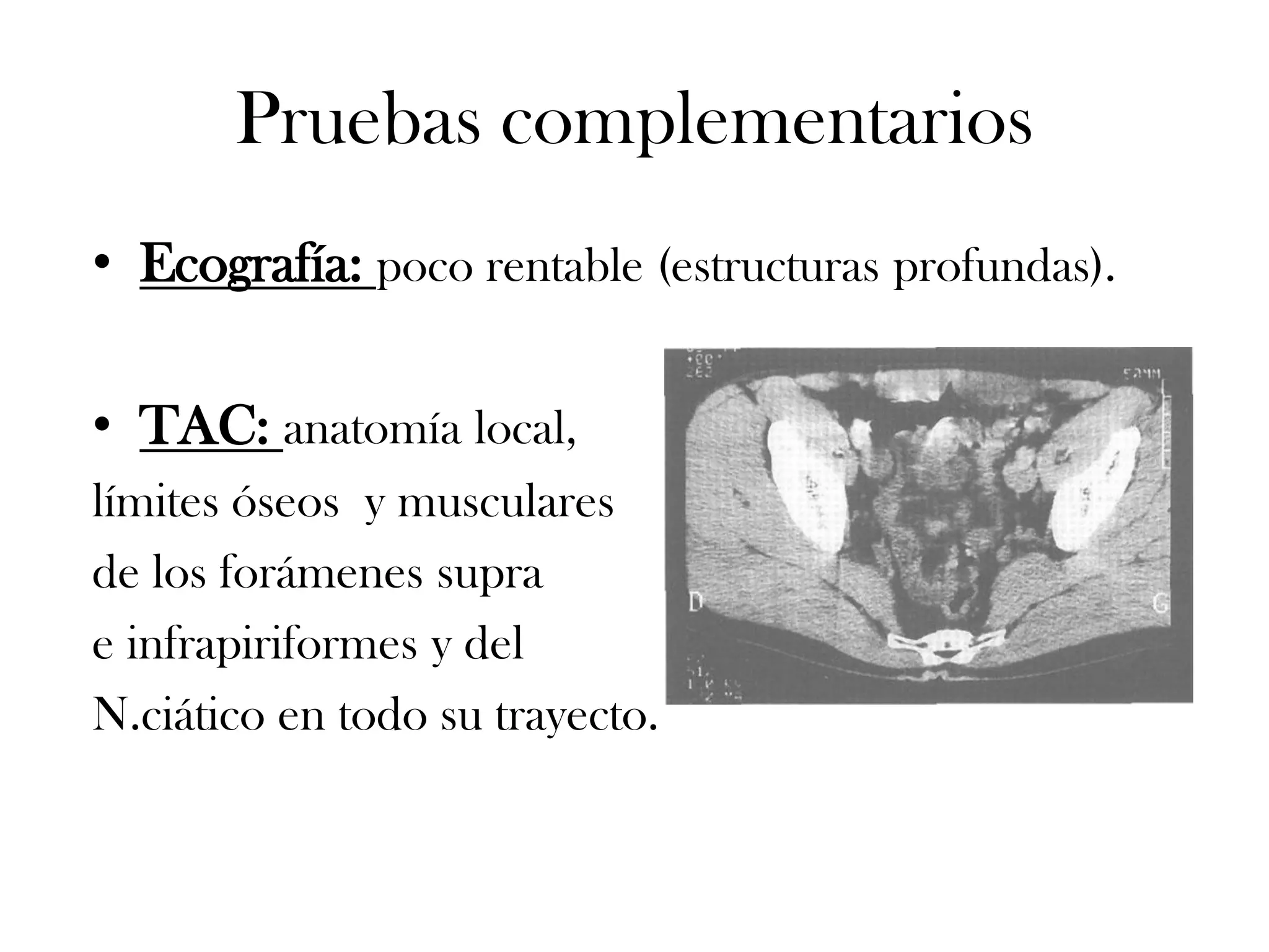 Pruebas complementarios
• Ecografía: poco rentable (estructuras profundas).

• TAC: anatomía local,
límites óseos y musculares
de los forámenes supra
e infrapiriformes y del
N.ciático en todo su trayecto.
 